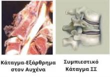 spinal_cord_injuries